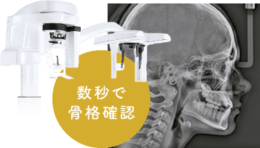 数秒で骨格確認