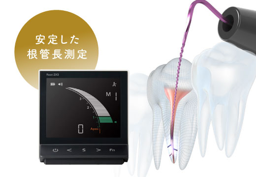 安定した根管長測定