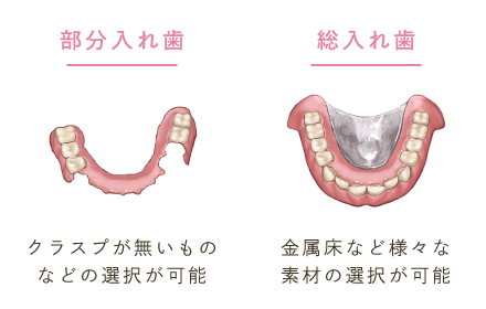 部分入れ歯：クラスプが無いものなどの選択が可能/総入れ歯：金属床など様々な素材の選択が可能